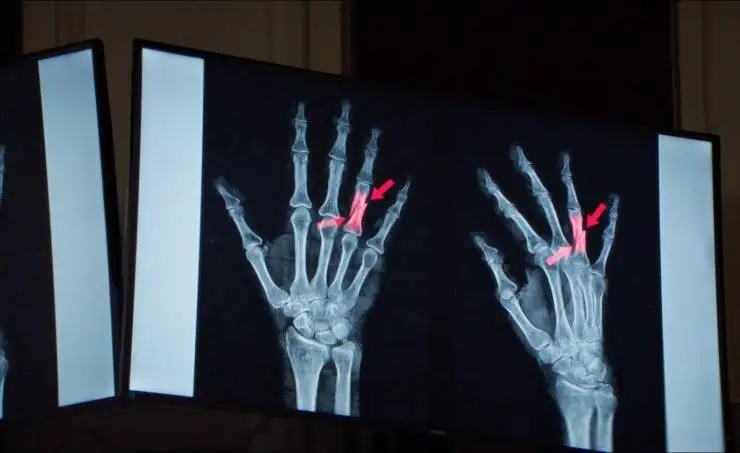 Анатомия падения (2023) в хорошем качестве через торрент Анатомия падения (2023) фильм в хорошем качестве через торрент